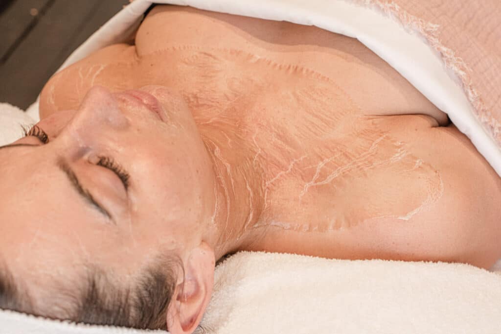 Acne Treatments Brisbane - PRIN Lymphatic Therapy Facial
